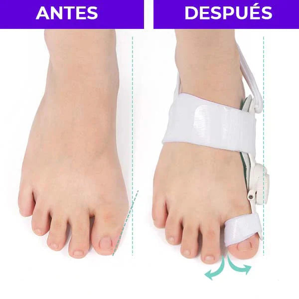 Corrector De Juanete Pro Bisagra Graduable