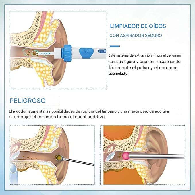LIMPIA OIDOS INTELIGENTE | SUCCIÓN Y VIBRACIÓN