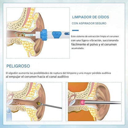 LIMPIA OIDOS INTELIGENTE | SUCCIÓN Y VIBRACIÓN