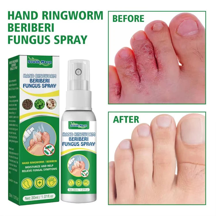 Spray Antifúngico para Pie de Atleta 2x1